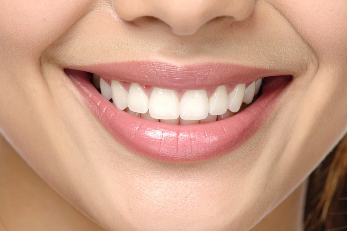 Голливудская улыбка GK Dental Clinic