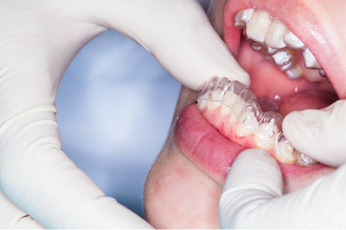 Ортодонтическое лечение GK Dental Clinic
