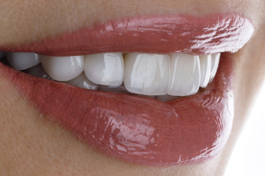 Фарфоровые коронки GK Dental Clinic