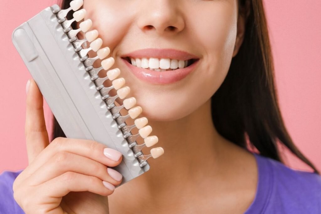 Dental Veneers Cost in Antalya
