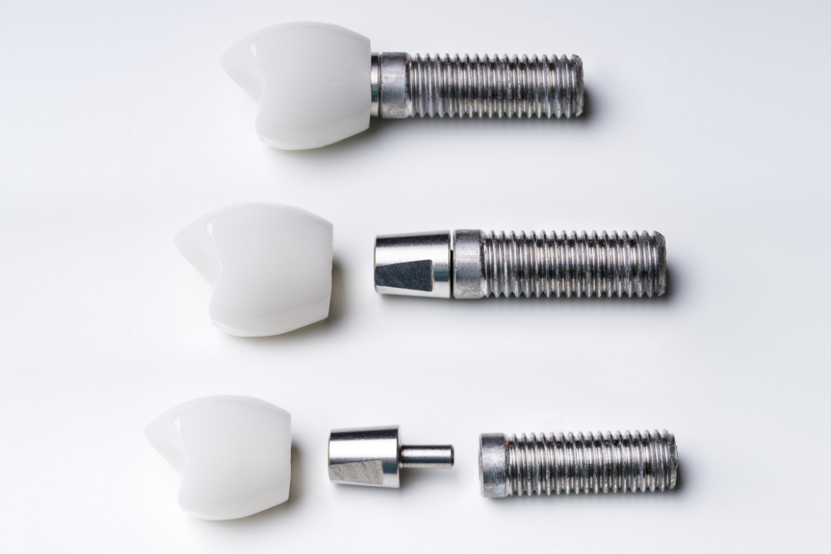 Dental implants